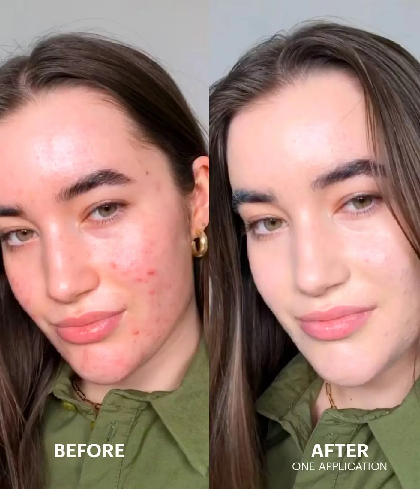 Cicapair Tiger Grass Color Correcting Treatment SPF22